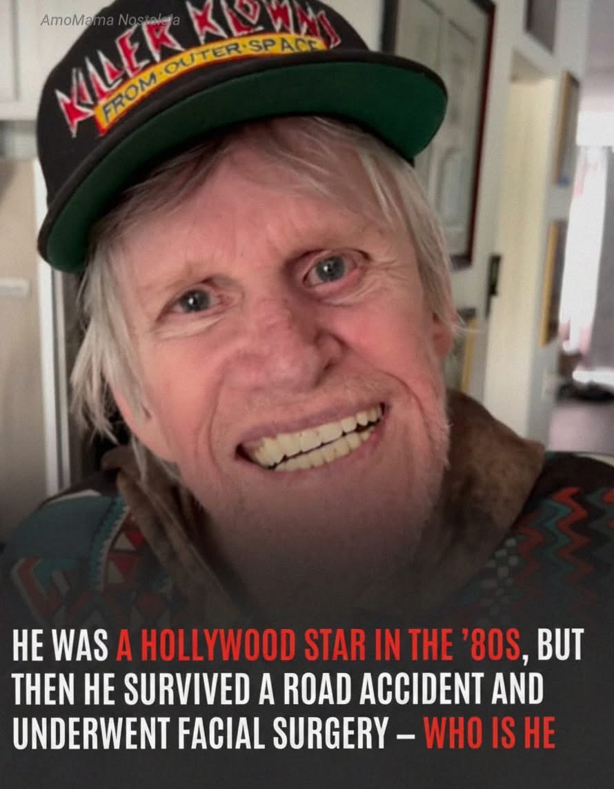 He Was A Hollywood Star In The ’80s, But Then Survived A Terrible Road Accident & Underwent Facial Surgery – His Pics At 81